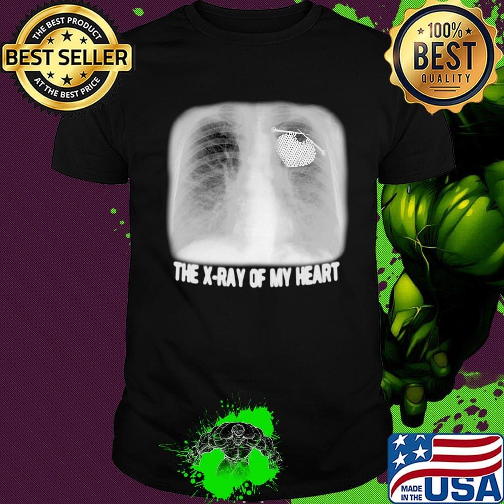 The X-ray Of My Heart Black White Shirt