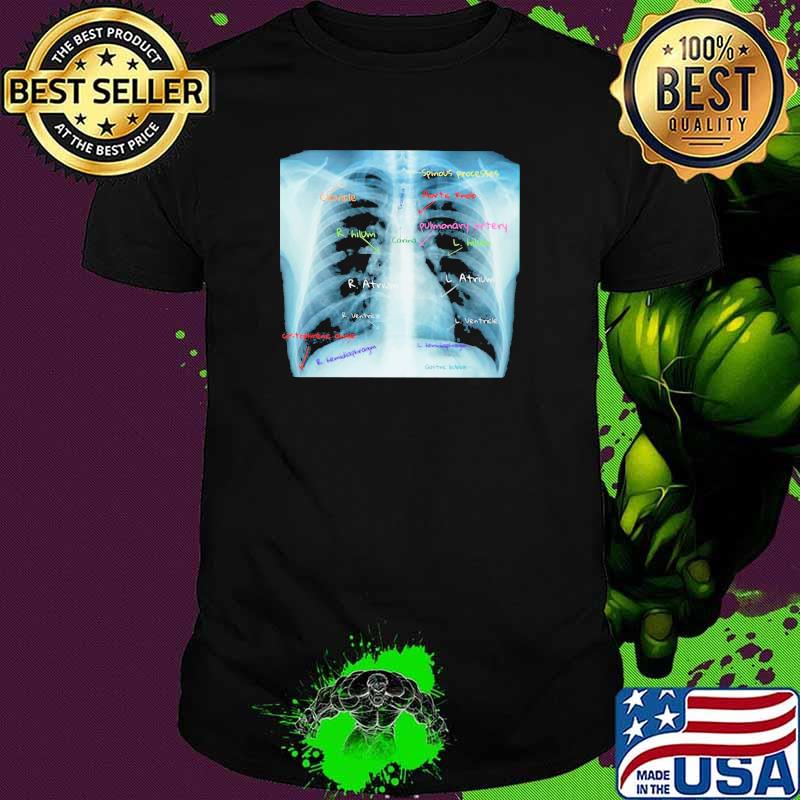 Chest X Ray With Labels Shirt